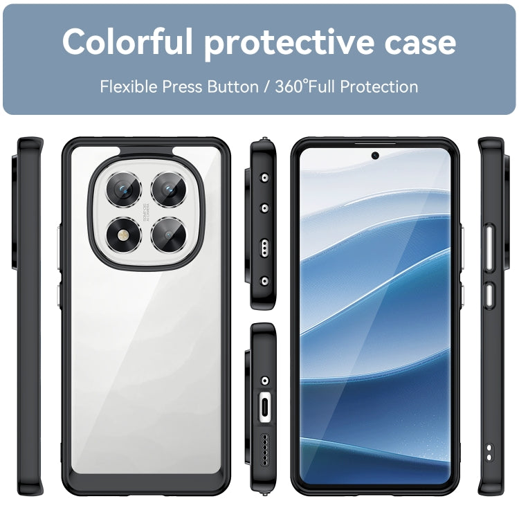 Colorful Series Acrylic Hybrid TPU Phone Case, For Redmi Note 14 Pro 5G, For Redmi 14C 4G, For Redmi K70 Ultra, For Redmi 13 4G